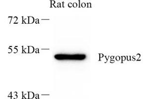 Western blot analysis of Pygopus2 (ABIN7075325) at dilution of 1: 300