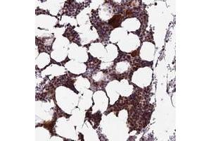 Immunohistochemical staining of human bone marrow with KIAA1984 polyclonal antibody  shows strong cytoplasmic and nuclear positivity in hematopoietic cells at 1:200-1:500 dilution. (CCDC183/KIAA1984 anticorps)