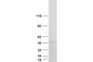 Validation with Western Blot