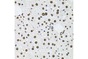 Immunohistochemistry of paraffin-embedded mouse liver using MCL1 antibody at dilution of 1:100 (x40 lens). (MCL-1 anticorps)