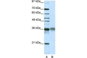 Western Blotting (WB) image for anti-T-Cell Leukemia Homeobox 2 (TLX2) antibody (ABIN2461873) (TLX2 anticorps)