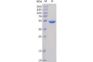 Human BAFF Protein, hFc Tag on SDS-PAGE under reducing condition. (BAFF Protein (Fc Tag))