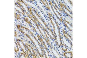 Immunohistochemistry of paraffin-embedded mouse kidney using HEXA antibody (ABIN6127519, ABIN6141730, ABIN6141732 and ABIN6216071) at dilution of 1:100 (40x lens). (Hexosaminidase A anticorps  (AA 270-529))