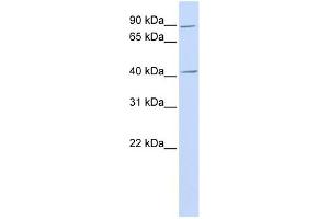 USP18 antibody used at 1 ug/ml to detect target protein. (USP18 anticorps  (N-Term))