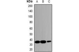 Western blot analysis of ZNT2 expression in HeLa (A), RAW264. (SLC30A2 anticorps)