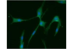 ICC/IF analysis of Homer1 in U87MG cells line, stained with DAPI (Blue) for nucleus staining and monoclonal anti-human Homer1 antibody (1:100) with goat anti-mouse IgG-Alexa fluor 488 conjugate (Green).