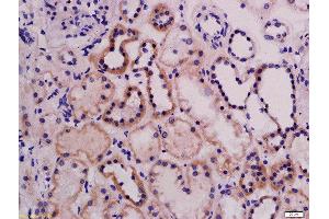 Formalin-fixed and paraffin embedded rat kidney labeled with Rabbit Anti-ABI3 Polyclonal Antibody, Unconjugated  at 1:200 followed by conjugation to the secondary antibody and DAB staining