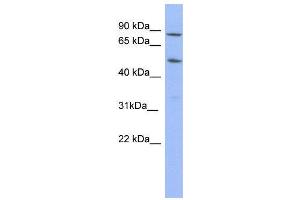 WB Suggested Anti-TRIM10  Antibody Titration: 0. (TRIM10 anticorps  (N-Term))