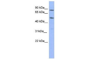 WB Suggested Anti-TRIM10  Antibody Titration: 0. (TRIM10 anticorps  (N-Term))