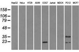 Western blot analysis of extracts (35 µg) from 9 different cell lines by using anti-CRYAB monoclonal antibody. (CRYAB anticorps)