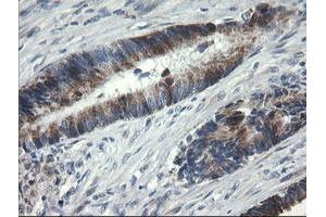 Image no. 1 for anti-UDP-GlcNAc:BetaGal beta-1,3-N-Acetylglucosaminyltransferase 2 (B3GNT2) antibody (ABIN1496800)