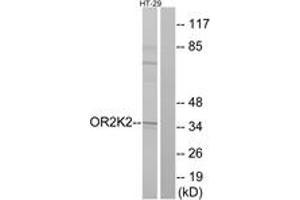 Western blot analysis of extracts from HT-29 cells, using OR2K2 Antibody. (OR2K2 anticorps  (AA 241-290))