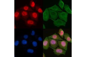 ABIN6259170 and ABIN6275473 staining Hela cells by IF/ICC. (RAB7L1 anticorps  (Internal Region))