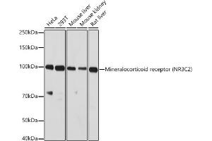 Western blot analysis of extracts of various cell lines, using Mineralocorticoid receptor (NR3C2) antibody (ABIN1681109, ABIN3017672, ABIN3017673 and ABIN6220207) at 1:1000 dilution. (NR3C2 anticorps  (C-Term))