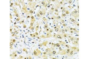 Immunohistochemistry of paraffin-embedded Human liver using ITGB3BP Polyclonal Antibody at dilution of 1:100 (40x lens).