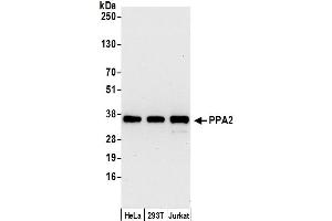 Western Blotting (WB) image for anti-Pyrophosphatase 2 (PPA2) (AA 284-334) antibody (ABIN7450587)