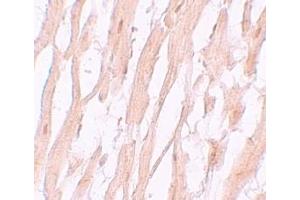 Immunohistochemistry (IHC) image for anti-ATG9 Autophagy Related 9 Homolog A (S. Cerevisiae) (ATG9A) (C-Term) antibody (ABIN1030264)
