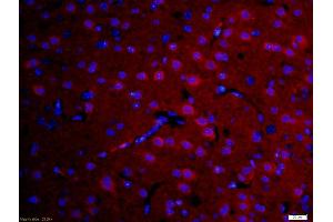 Formalin-fixed and paraffin-embedded rat brain labeled with Anti-DFFB Polyclonal Antibody, Unconjugated (ABIN724085) 1:200, overnight at 4°C, The secondary antibody was Goat Anti-Rabbit IgG, Cy3 conjugated used at 1:200 dilution for 40 minutes at 37°C. (DFFB anticorps  (AA 201-260))