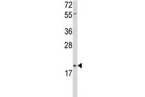 Western blot analysis of DLK2 antibody and HL-60 lysate.