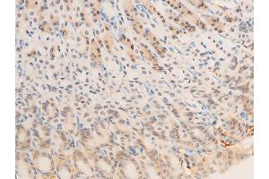 ABIN6267269 at 1/100 staining mouse gastric tissue sections by IHC-P. (EGFR anticorps  (pSer1071))
