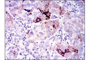Immunohistochemistry (IHC) image for anti-Secreted phosphoprotein 1 (SPP1) (AA 167-314) antibody (ABIN1845756)