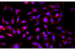 Immunofluorescence analysis of HepG2 cells using GCK Polyclonal Antibody at dilution of 1:100 (GCK anticorps)