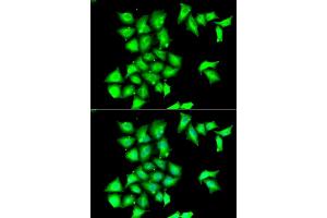Immunofluorescence analysis of HeLa cells using MSRB1 antibody (ABIN6129123, ABIN6144089, ABIN6144090 and ABIN6222462). (MSRB1 anticorps  (AA 1-94))