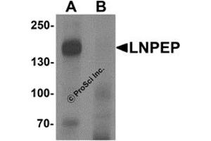 Western Blotting (WB) image for anti-Leucyl/cystinyl Aminopeptidase (LNPEP) (C-Term) antibody (ABIN1077382) (LNPEP anticorps  (C-Term))
