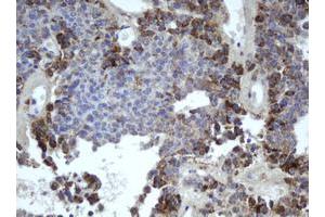 Image no. 1 for anti-Mitochondrial Intermediate Peptidase (MIPEP) (AA 174-516) antibody (ABIN1491019)