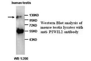Image no. 1 for anti-Piwi-Like 2 (PIWIL2) (C-Term) antibody (ABIN791010) (PIWIL2 anticorps  (C-Term))