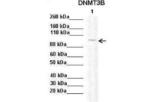 Sample Type :  Lane 1: 20ug mouse mesenchymal stem cell lysate  Primary Antibody Dilution :   1:2000  Secondary Antibody:  Anti-rabbit-HRP  Secondary Antibody Dilution:   1:10,000  Color/Signal Descriptions:  DNMT3B  Gene Name:  Anonymous  Submitted by: (DNMT3B anticorps  (Middle Region))
