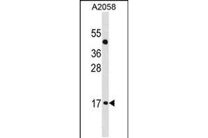 Western blot analysis in A2058 cell line lysates (35ug/lane). (ATOH7 anticorps  (AA 85-112))