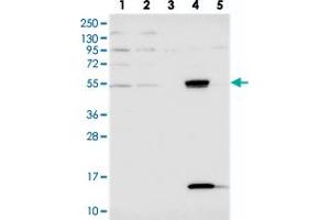 Western blot analysis of Lane 1: RT-4, Lane 2: U-251 MG, Lane 3: Human Plasma, Lane 4: Liver, Lane 5: Tonsil with UFSP2 polyclonal antibody  at 1:250-1:500 dilution. (UFSP2 anticorps)