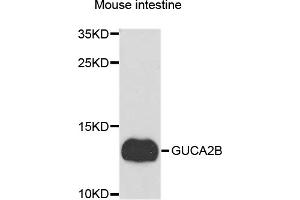 Western blot analysis of extracts of mouse small intestine, using GUCA2B antibody. (GUCA2B anticorps)