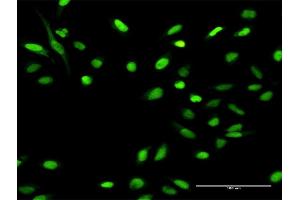 Immunofluorescence of purified MaxPab antibody to MCM4 on HeLa cell. (MCM4 anticorps  (AA 1-863))