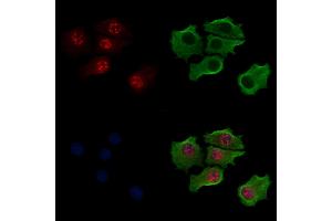 Phospho-Bub1 (Thr461) Antibody staining HepG2 cells(serum starvation treatment) by IF/ICC.