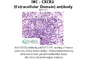 Image no. 1 for anti-Chemokine (C-X-C Motif) Receptor 2 (CXCR2) (2nd Extracellular Domain) antibody (ABIN1733394) (CXCR2 anticorps  (2nd Extracellular Domain))