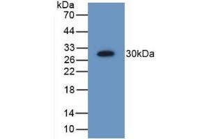 Detection of Recombinant PSMD9, Human using Polyclonal Antibody to Proteasome 26S Subunit, Non ATPase 9 (PSMD9) (Proteasome 26S Subunit, Non ATPase 9 (AA 2-223) anticorps)