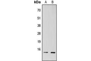 Western blot analysis of TAF13 expression in HEK293T (A), H9C2 (B) whole cell lysates. (TAF13 anticorps  (Center))