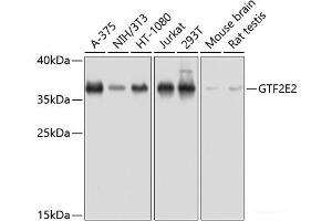 Western blot analysis of extracts of various cell lines using GTF2E2 Polyclonal Antibody at dilution of 1:1000. (GTF2E2 anticorps)