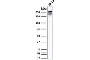 Western Blot Analysis of HeLa cell lysates using Spectrin beta III Rabbit Recombinant Monoclonal (SPTBN2/2894R).