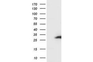 Image no. 4 for anti-Synovial Sarcoma, X Breakpoint 1 (SSX1) antibody (ABIN1501159) (SSX1 anticorps)
