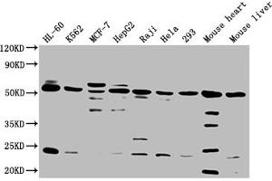 Western Blot Positive WB detected in: HL60 whole cell lysate, K562 whole cell lysate, MCF-7 whole cell lysate, HepG2 whole cell lysate, Raji whole cell lysate, Hela whole cell lysate, 293 whole cell lysate, Mouse heart tissue, Mouse liver tissue All lanes: NCR3LG1 antibody at 1:2000 Secondary Goat polyclonal to rabbit IgG at 1/50000 dilution Predicted band size: 51 kDa Observed band size: 51 kDa