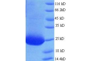 CTAG2 Protein (AA 1-210, full length) (His-SUMO Tag)