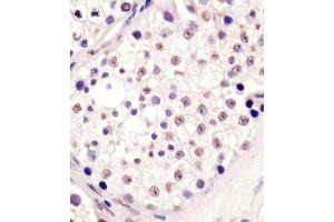 (ABIN6242809 and ABIN6578637) staining MLL3 in human testis tissue sections by Immunohistochemistry (IHC-P - paraformaldehyde-fixed, paraffin-embedded sections). (MLL3 anticorps  (N-Term))