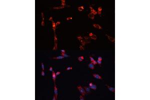 Immunofluorescence analysis of NIH/3T3 cells using MMP16 antibody (ABIN6132356, ABIN6143906, ABIN6143907 and ABIN6214654) at dilution of 1:100.