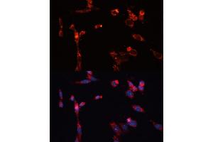 Immunofluorescence analysis of NIH/3T3 cells using MMP16 antibody (ABIN6132356, ABIN6143906, ABIN6143907 and ABIN6214654) at dilution of 1:100. (MMP16 anticorps  (AA 290-565))