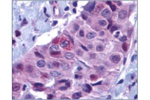 Image no. 1 for anti-BCL2 Binding Component 3 (BBC3) (N-Term) antibody (ABIN264889) (PUMA anticorps  (N-Term))