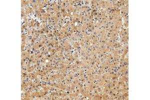 IHC analysis of Alpha 2-Antiplasmin/SERPINF2 using anti-Alpha 2-Antiplasmin/SERPINF2 antibody (ABIN7601808). (alpha 2 Antiplasmin anticorps  (AA 461-491))