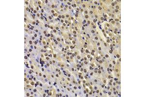 Immunohistochemistry of paraffin-embedded mouse kidney using FBXW7 antibody (ABIN5975397) at dilution of 1/100 (40x lens). (FBXW7 anticorps)